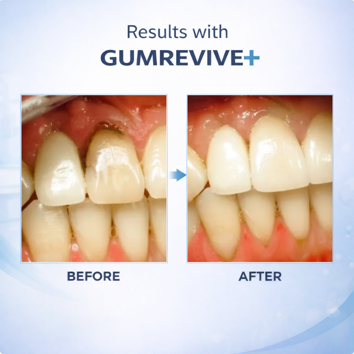 Dentira GUMREVIVE+ Ozonated Oil Pulling