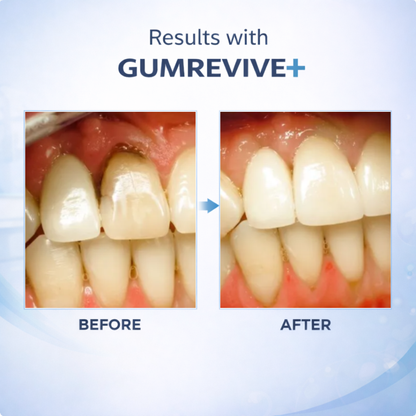 Dentira GUMREVIVE+ Ozonated Oil Pulling