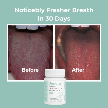 Orivita™ Oral Health Probiotic Mints